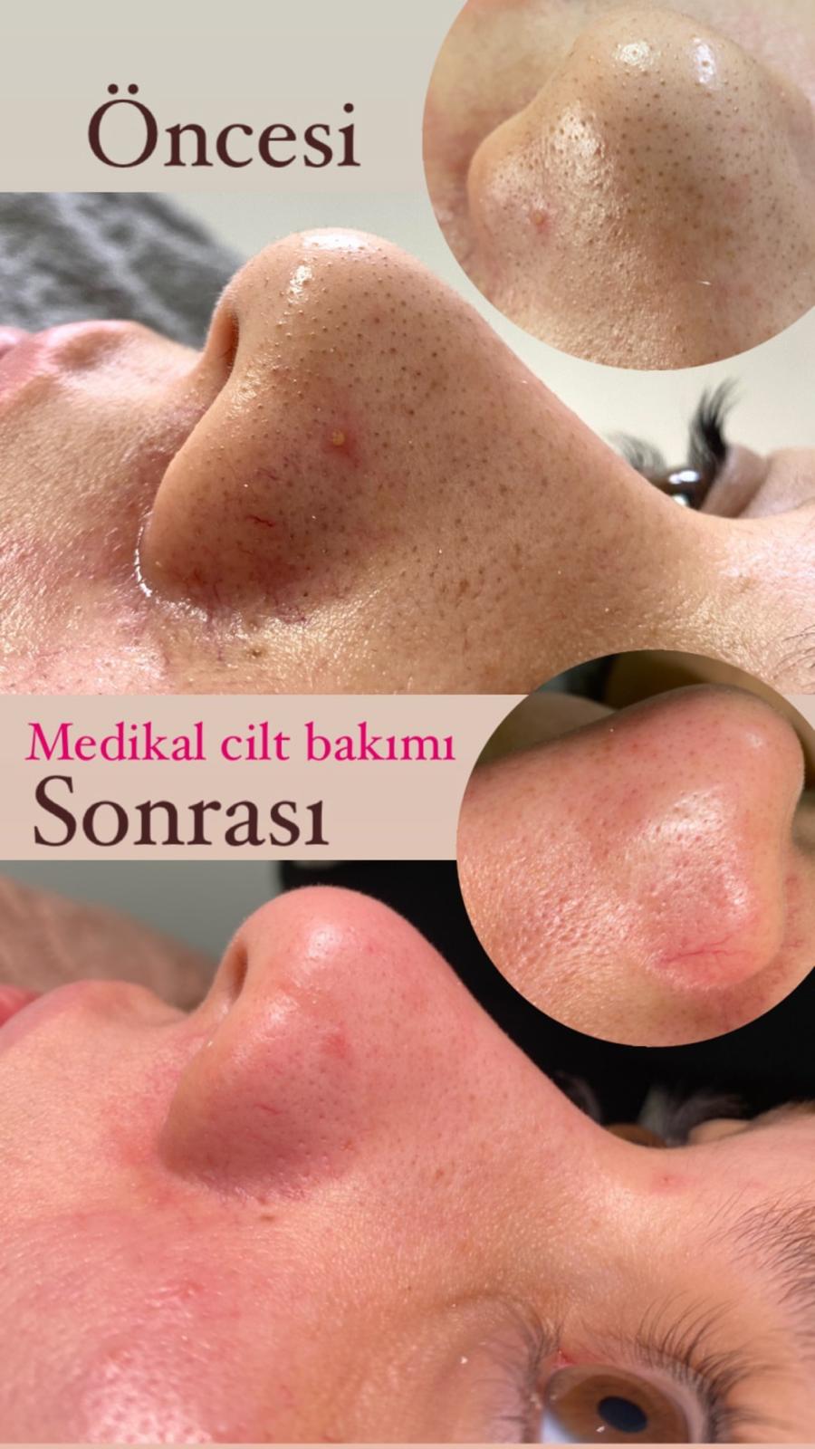 Balıkesir Sion Vip fotoğraf 3