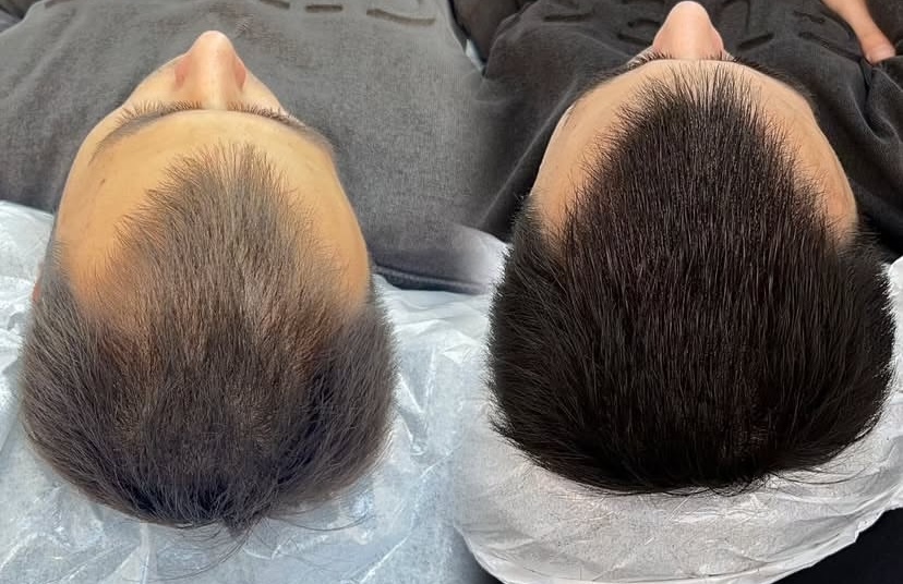 Fossette Güzellik Salonu fotoğraf 2